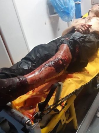 Avtobusa silahlı basqın və sərnişinin döyülməsi barədə şok görüntülər yayılıb - FOTO/VİDEO Avtobusa silahlı basqın və sərnişinin döyülməsi barədə şok görüntülər yayılıb - FOTO/VİDEO